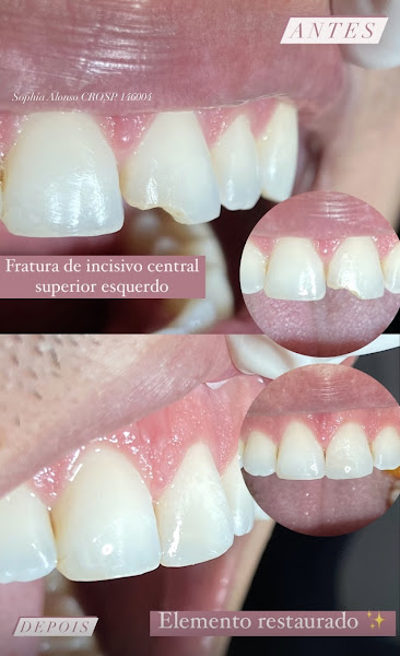 Foto 3 de Dra. Sophia Alonso - Harmonização Orofacial e Odontologia