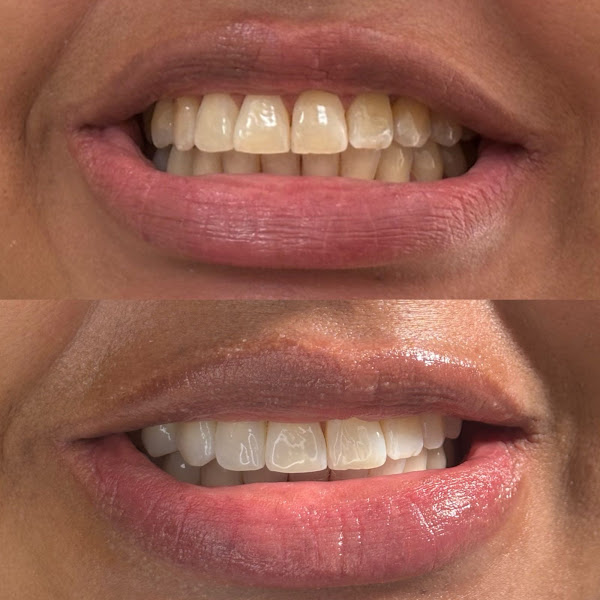 Foto 2 de Dra. Soraya Okuyama - Cirurgiã Dentista