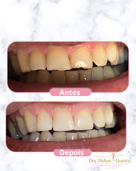 Foto 3 de Dra Stefani Queiroz