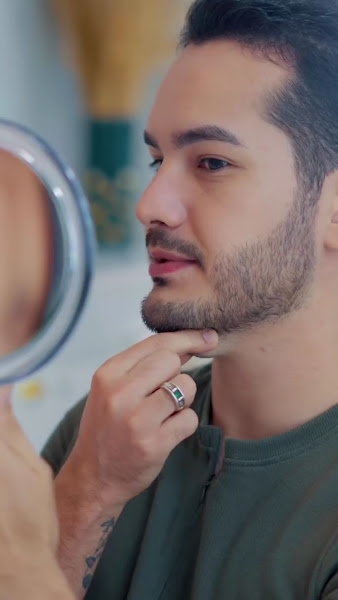 Foto 3 de Dra. Stefanny Vieira - Preenchimento Labial e Botox em Parauapebas