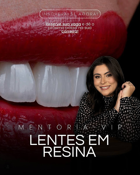 Foto 2 de Dra. Stela Campos | Lentes em Resina | Dentista | Consultório Odontológico