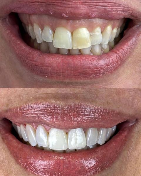 Foto 3 de Dra. Suellem Santos