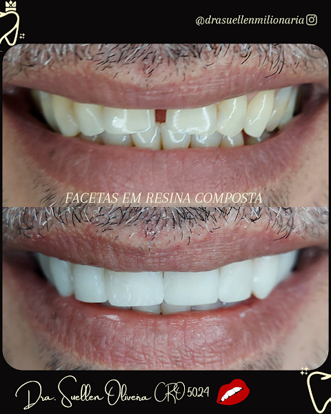 Foto 3 de Dra. Suellen Oliveira Consultório Odontológico