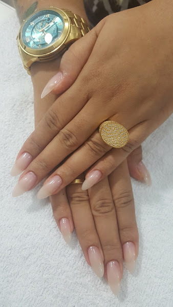 Foto 3 de Dra Suellen Venâncio Harmonização Facial Taquara | Rinomodelação | Botox | Preenchimento Full Face | Sculptra | Radiesse