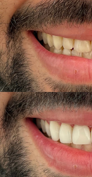 Foto 2 de Dra Suzana Guerta - Cirurgiã-Dentista em Volta Redonda