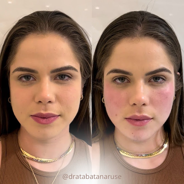 Foto 3 de Dra Tábata Naruse - Harmonização Facial | Ortodontia | Invisaling