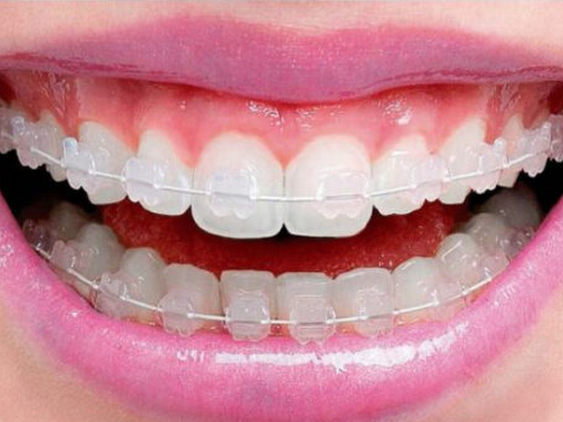 Foto de Dra Taciana Palamoni Rio Preto - Ortodontia para todas as idades. Aparelhos Invisíveis e todos os tipos de aparelhos.