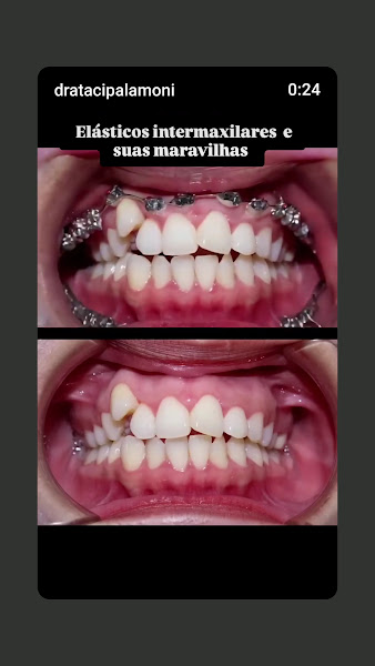 Foto 3 de Dra Taciana Palamoni Rio Preto - Ortodontia para todas as idades. Aparelhos Invisíveis e todos os tipos de aparelhos.