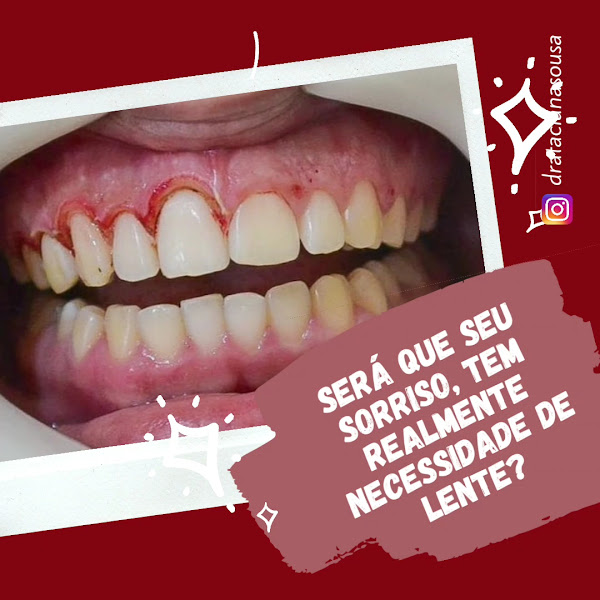 Foto 3 de Dra.Taciana Sousa - Odontologia e Estetica Avançada