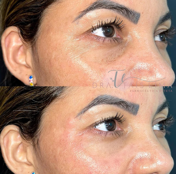 Foto 2 de Dra. Taís Lima Estética em Taboão da Serra – Botox e Harmonização Facial