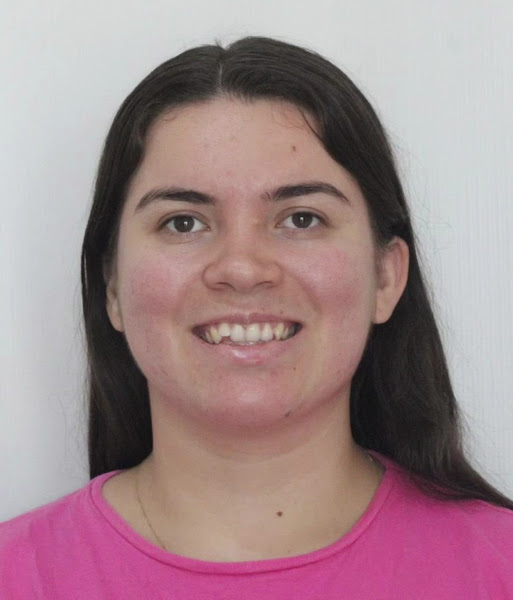 Foto 5 de Dra.Taiza R. Cardôso/Harmonizaçāo Facial/Aparelho Invisalign/Lentes de Resina/Botox Rosto/Clínica Odontológica/Em Palmas