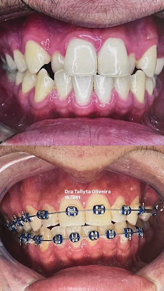 Foto 2 de Dra. Tallyta Oliveira - Barra Funda/ São Paulo