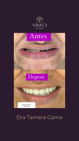 Foto 3 de Dra. Tamara Gama - Dentista em Fortaleza-Ce