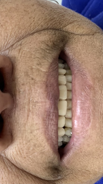 Foto 2 de Dra Tamires Cavalcante - Dentista