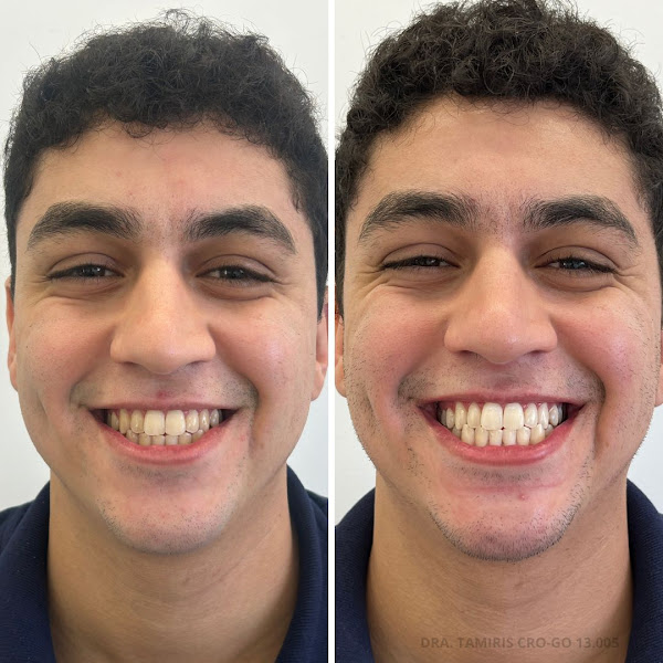 Foto 2 de Dra Tamiris Carolina - Cirurgiã Dentista