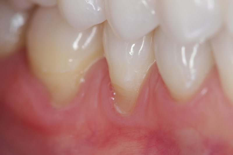 Foto 3 de Dra Tânia Rodrigues -Implante e Periodontia