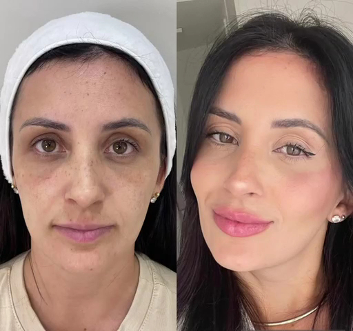 Foto 3 de Dra Tarcila Duarte Harmonização Orofacial Avançada