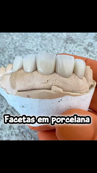 Foto 3 de Dra. Tati Quaresmin | Implantes Dentários e Estética