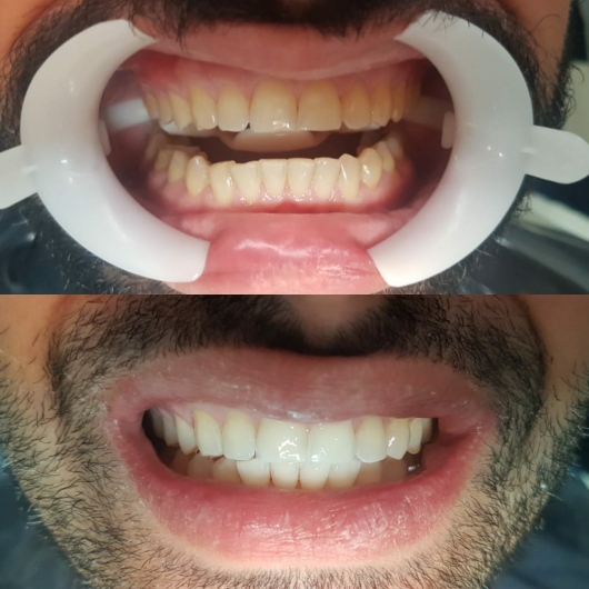 Foto 3 de Dra. Tatiana Pires, Dentista