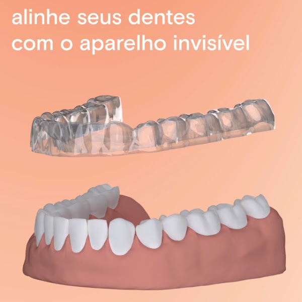 Foto 4 de Dra Tatiane Botta | Dentista | Alinhador Invisível | SouSmile | Uberaba