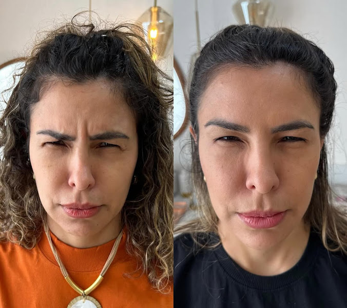 Foto 3 de Dra. Tauana Vanzella | Harmonização Facial em Porto Velho