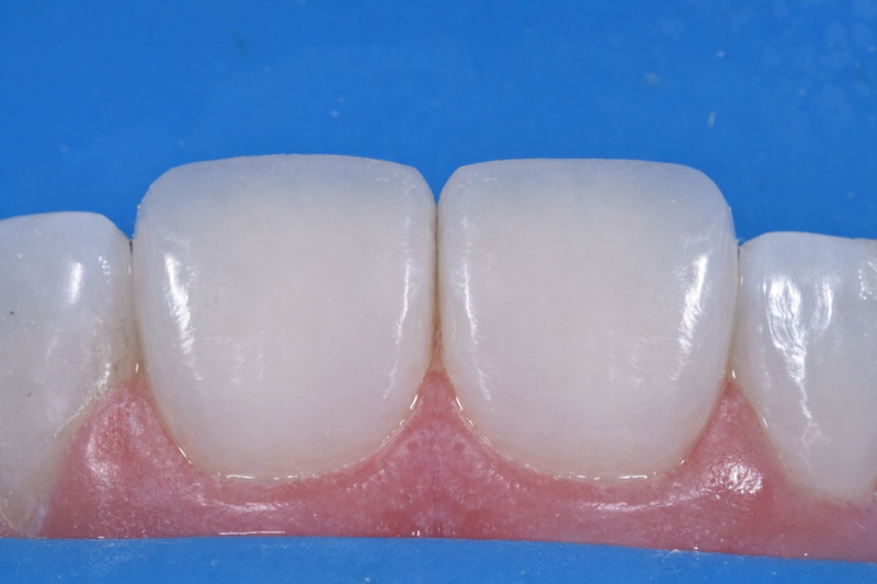 Foto 2 de Dra. Tayane Holz - Clínica Odontológica