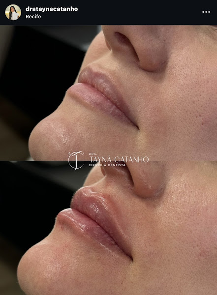 Foto 2 de Dra. Tayná Catanho