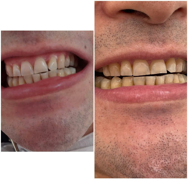 Foto 2 de Dra Telma Fingergut-.Dentista