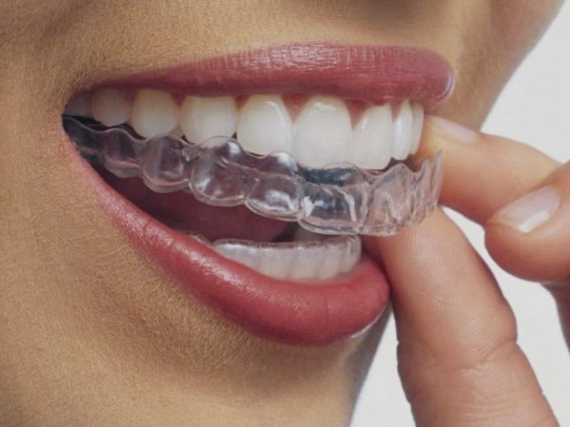 Foto de Dra. Telma Martins -Ortodontista - dentista do sono- tratamento do ronco e apneia -Harmonização