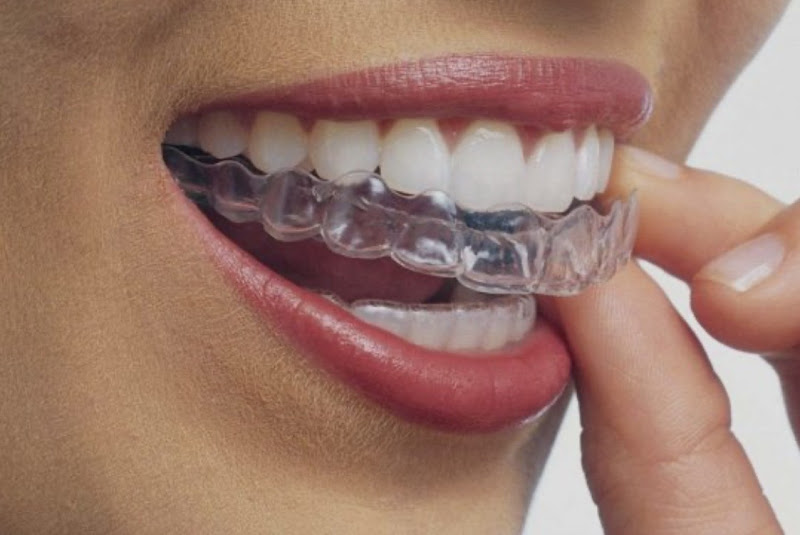 Foto 2 de Dra. Telma Martins -Ortodontista - dentista do sono- tratamento do ronco e apneia -Harmonização