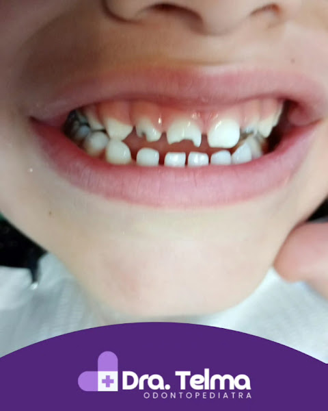 Foto 3 de Dra Telma odontopediatra PORTO ALEGRE
