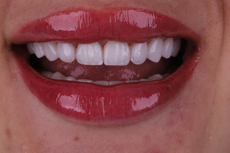 Foto 3 de Dra.Thaiane Sousa | Clareamento Dental | Lentes em Resina | Harmonização Facial | Dentista | Consultório Dental