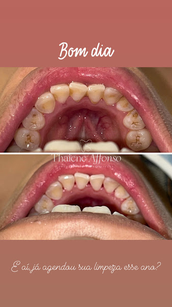 Foto 3 de Dra.Thaiene Affonso - Ortodontia e Implantodontia