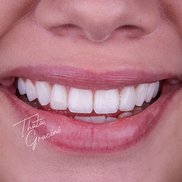 Foto 2 de Dra. Thainá Gracini - Consultório Odontológico