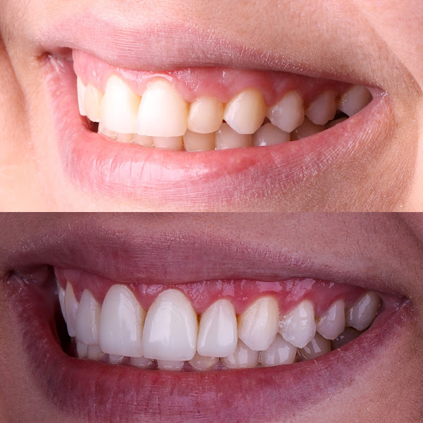 Foto 3 de Dra. Thainá Gracini - Consultório Odontológico