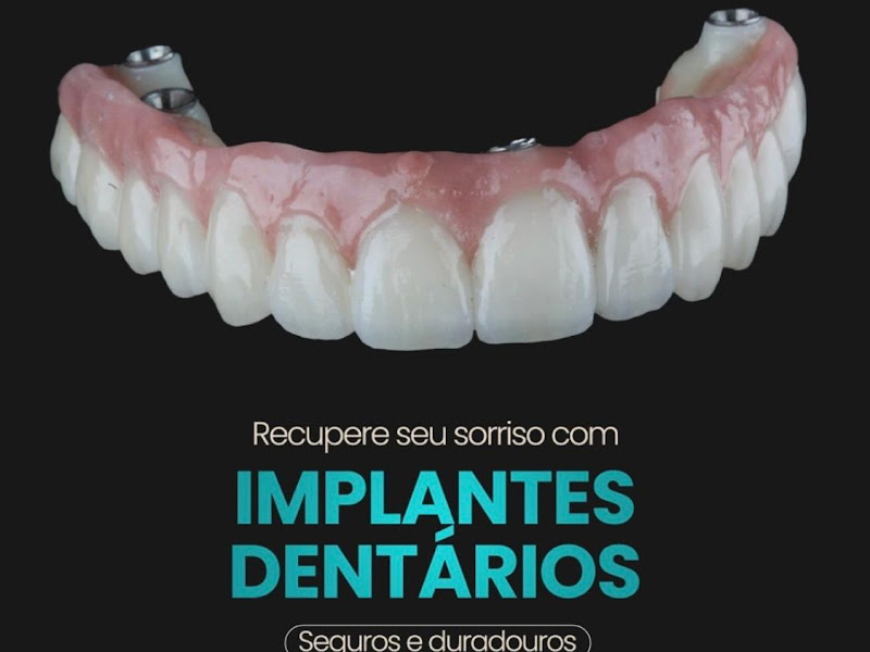 Foto 10 de Dra. Thaís Campregher Odontologia | Dentista em Santos - Aparelho Autoligado