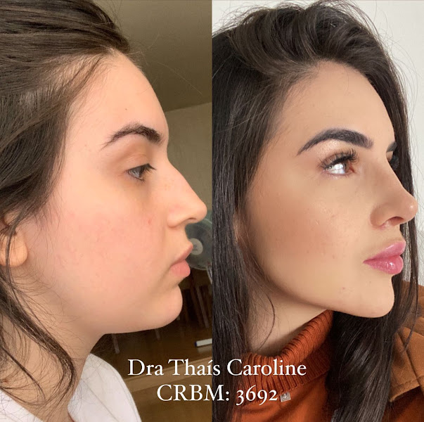 Foto 2 de Dra Thaís Caroline