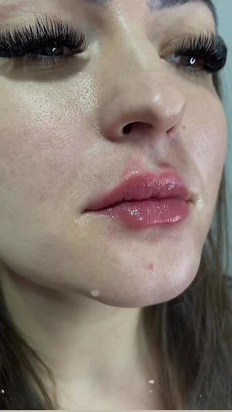 Foto 3 de Dra Thaís Caroline