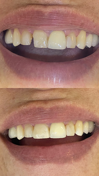 Foto 2 de Dra Thaís França| Cirurgiã Dentista| Clínico geral e Clareamento.