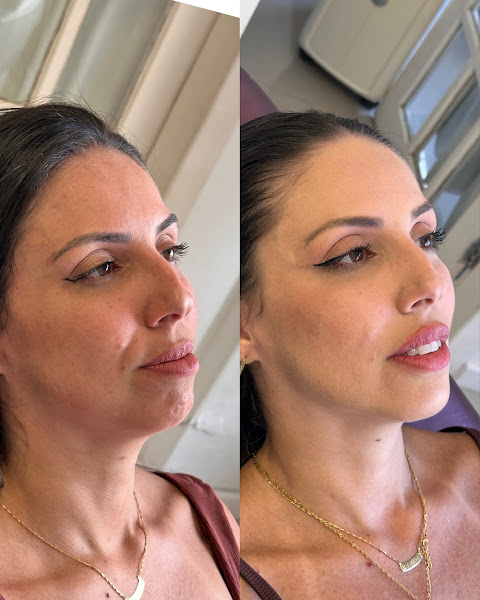 Foto 2 de Dra. Thaís Lopes | Harmonização Facial