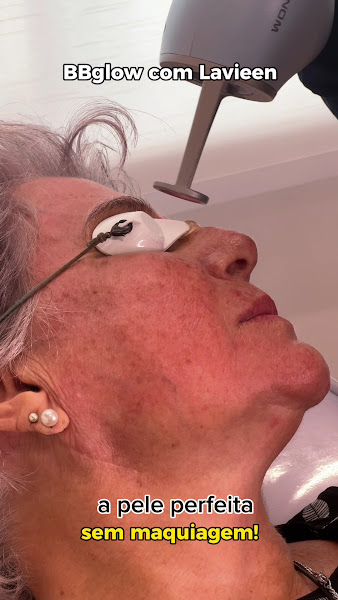 Foto 2 de Dra Thais Lopes - Harmonização Orofacial Rj