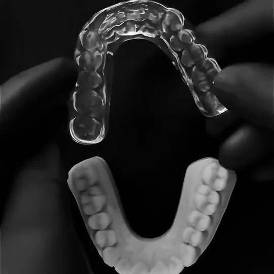 Foto 4 de Dra. Thais M. Allegretti | Dentista Estética, Alinhadores e Clareamento Dental | Limpeza dentária | Brooklin SP