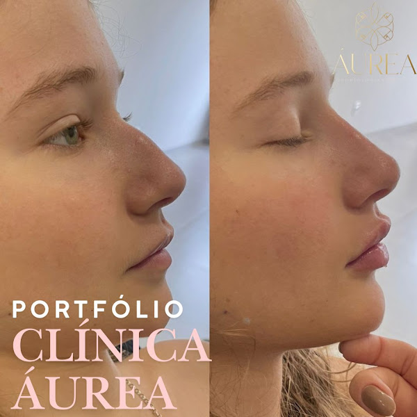 Foto 3 de Dra Thais Rigo - Clinica de Estética - Clinica Odontológica