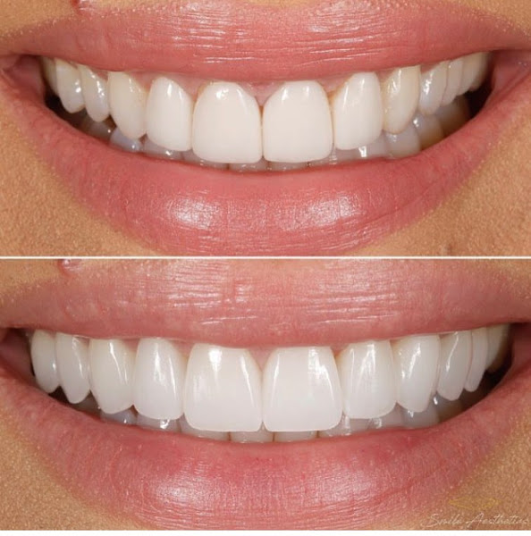 Foto 2 de Dra. Thais Risegato - Odontologia Integrativa em Jardim São Paulo - Restauração - Clareamento Dentário - Prótese Dentária