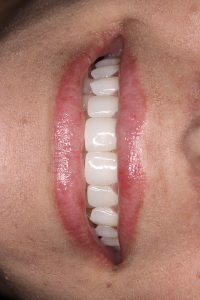 Foto 2 de Dra Thaís Rodrigues - Periodontia e Estética dental