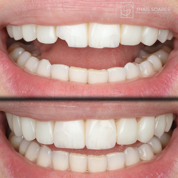 Foto 2 de Dra Thais Soares