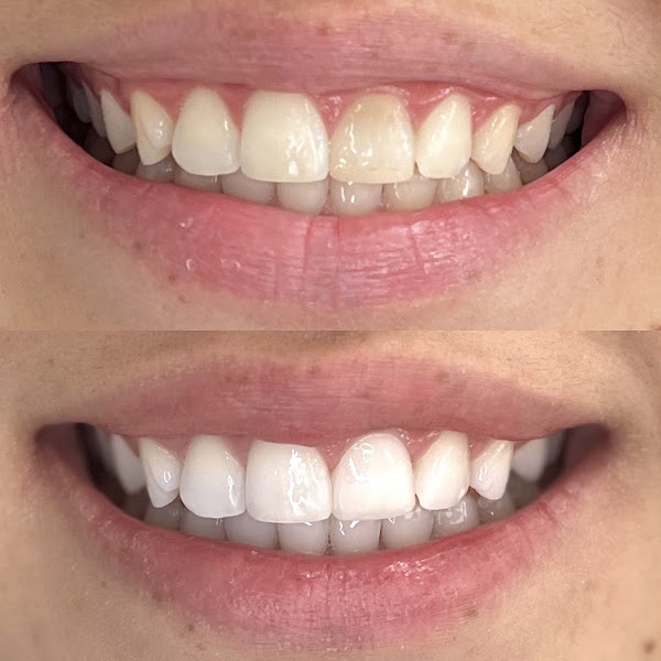 Foto 2 de Dra. Thaize Miranda - Especialista em endodontia