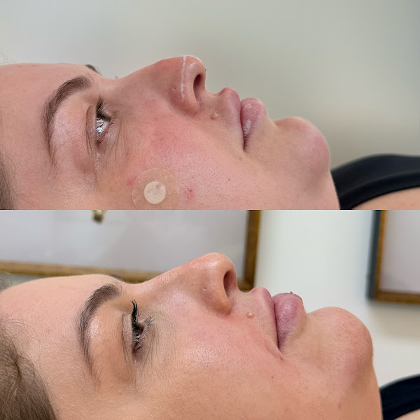 Foto 2 de Dra. Thalita Palma - Harmonização Orofacial | Botox, Preenchimento labial, Full face