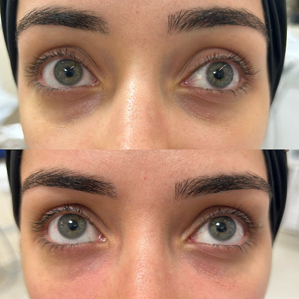 Foto 3 de Dra. Thalita Palma - Harmonização Orofacial | Botox, Preenchimento labial, Full face