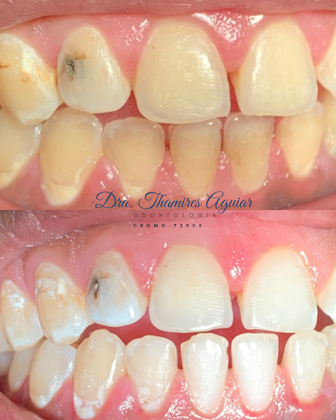 Foto 2 de Dra. Thamires Aguiar - Dentista em bh